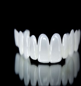 لمینت متحرک یک گزینه نوین و جذاب برای زیبایی دندان‌ها